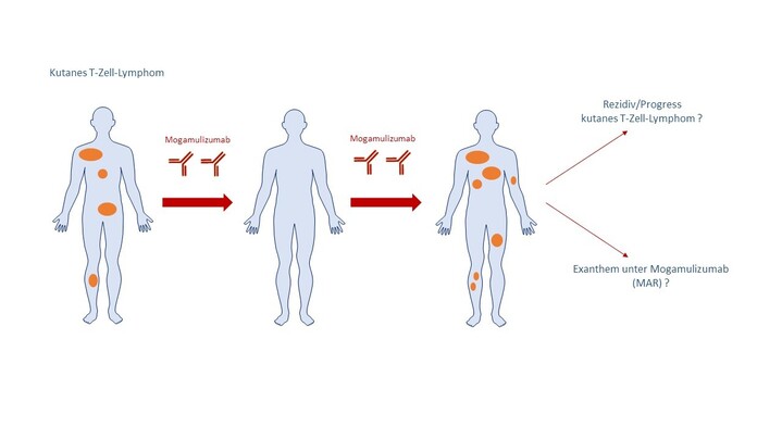 Abbildung-1-Ag-Wobser-Schrama-Hautklinik-Foschunghiilft
